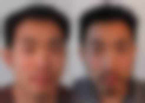 11、深圳碧莲盛植发医院24小时电话服务