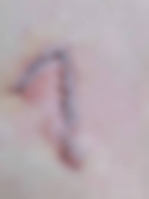 二、泉州石狮柏丽整形美容医院正规靠谱吗