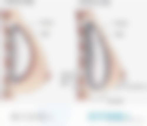 隆胸手术成效何时能理想呈现？