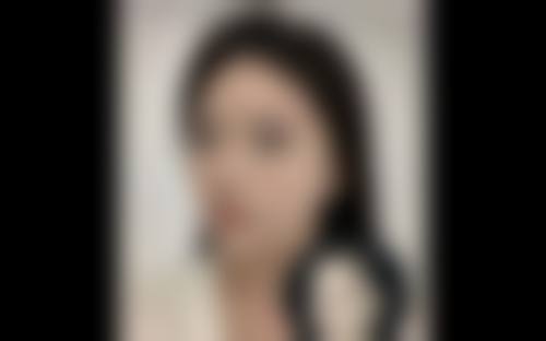 广州圣心微美整形医疗美容医院真实实例参考