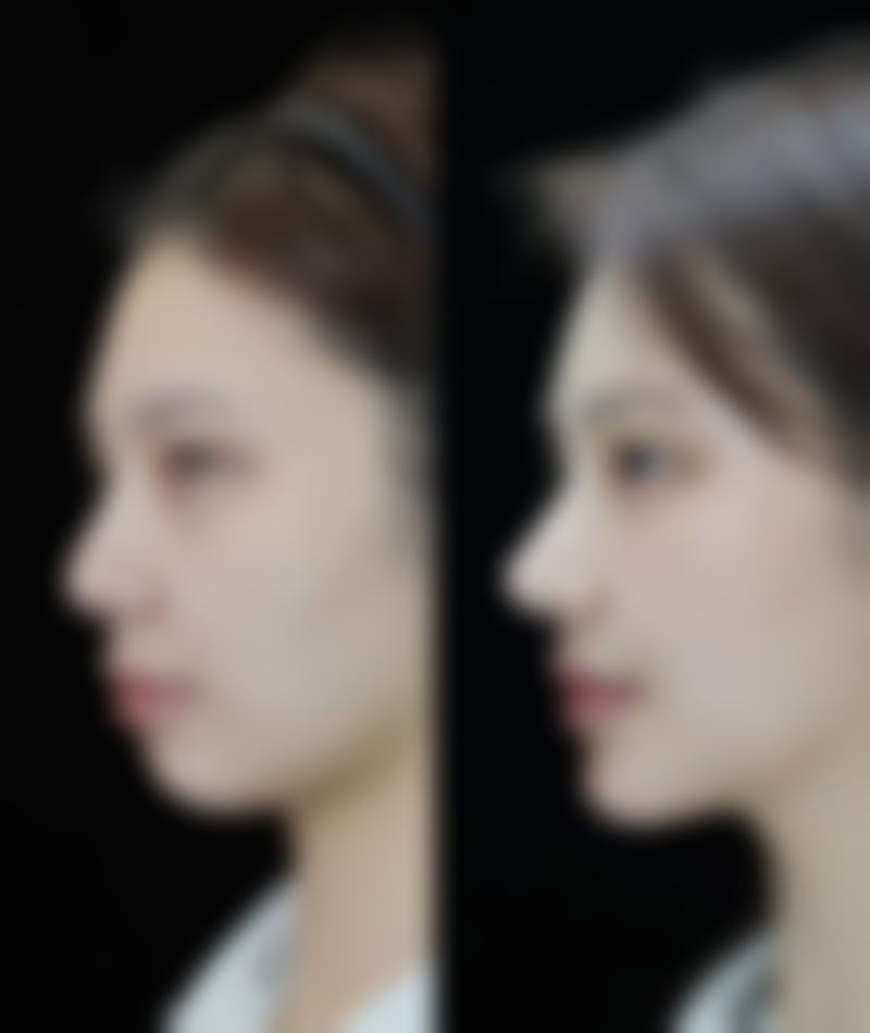 患者常见问题解答（精选 ）