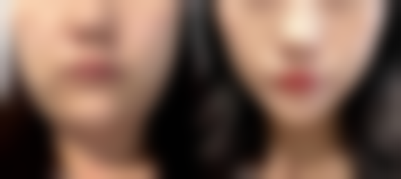 韩国KLEAM可丽皮肤科医院正规资质及靠谱实力