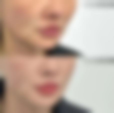 韩国LH整形外科诊疗项目