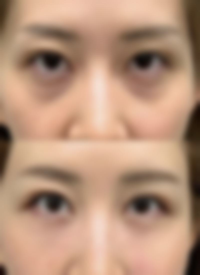 赵灿灿医生预约挂号方式