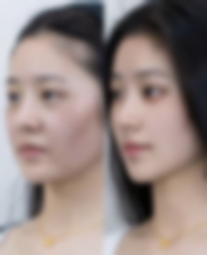 青岛瑧妍美地址电话及预约挂号指南