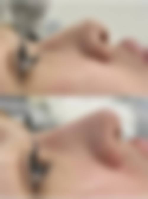 刘小婷医生擅长项目