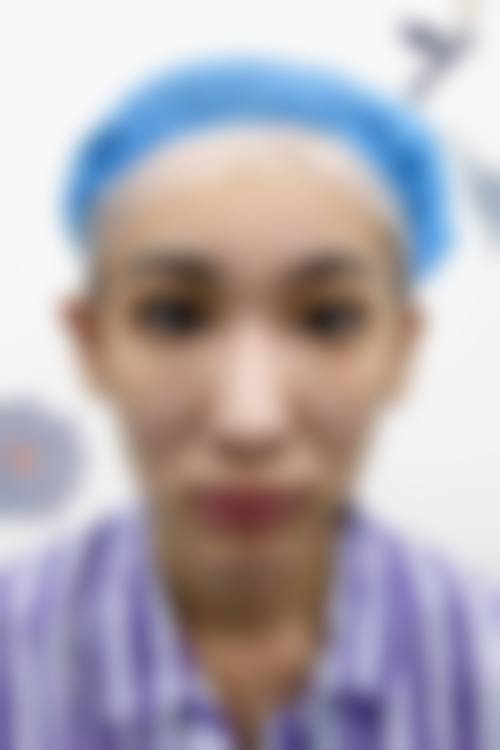 刘小婷医生技术优势