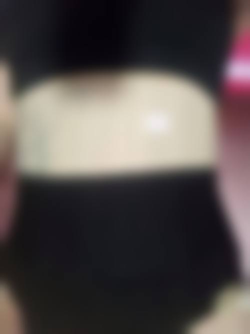 揭秘吸脂减肥手术的风险与潜在危害，这些坑千万别踩