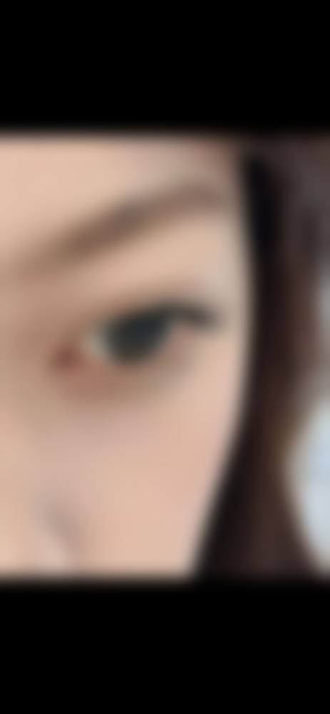 大兴熙朵植发口碑好不好?患者诊室评价: