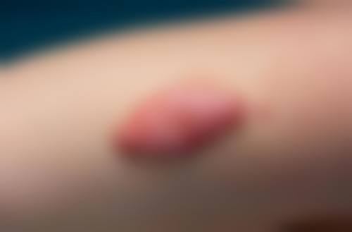 五、东营中亚医疗美容诊所价格表区间/收费标准说明