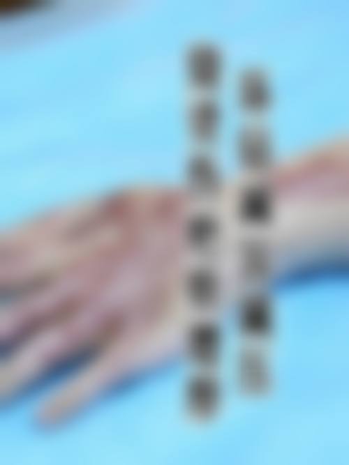 芙莱思整形外科口唇整形技术优势