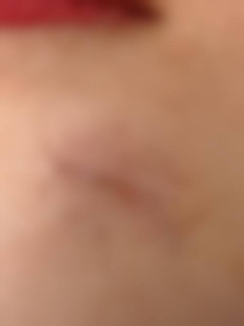 患者常见问题解答(精选 )