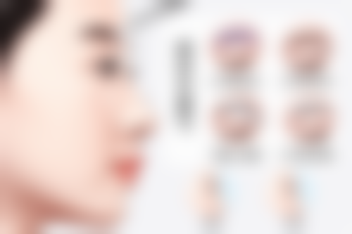 双眼皮是埋线好还是全切好？埋线3000 - 5000元恢复快，全切效果久适配多眼型！答案在这 