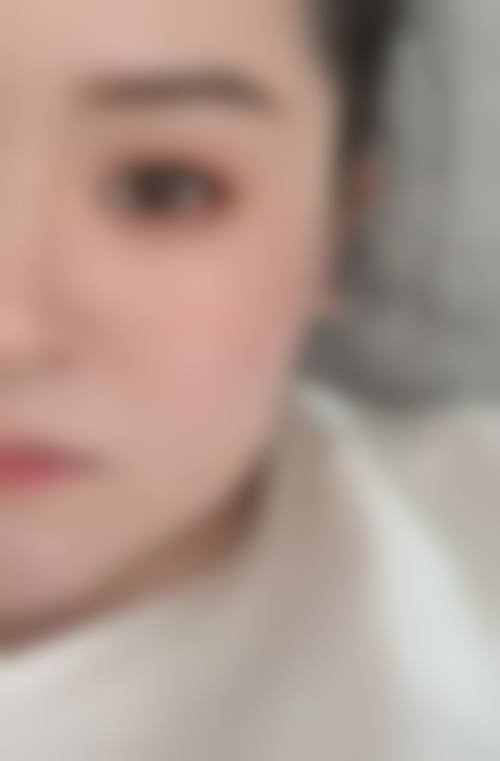 九、围绕打瘦脸针,临床中更常见的并发问题有哪些?