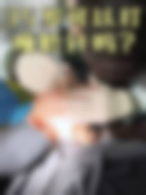 如何判断是否适合国产瘦脸针