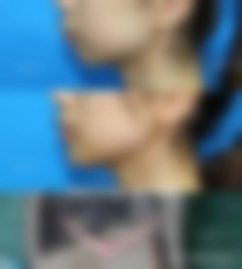 患者常见问题解答(精选 )