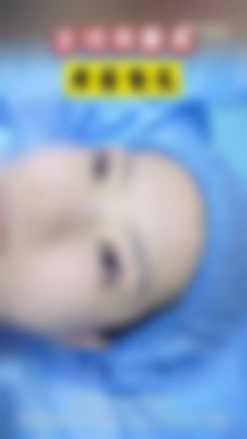 实例二：小张的美丽蜕变