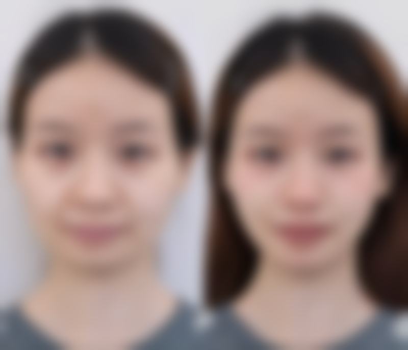 王春风医生收费标准一览