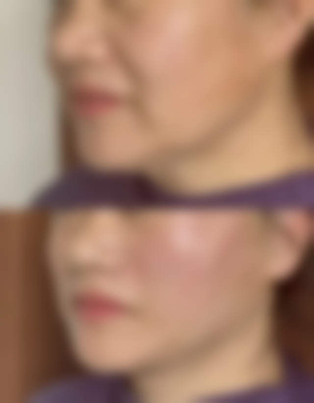 曼妮医生收费标准一览