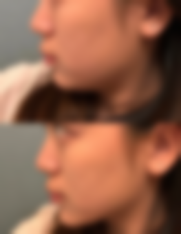 曼妮医生擅长项目