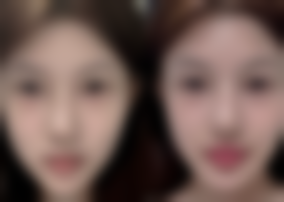 十一、患者常见问题解答