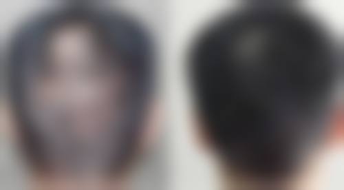 重庆五洲女子激光微整形医院地址电话及来院路线