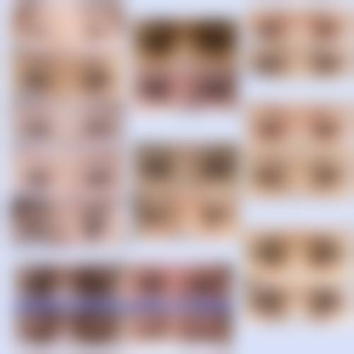 面部清洁与生活习惯调整——营造良好手术条件