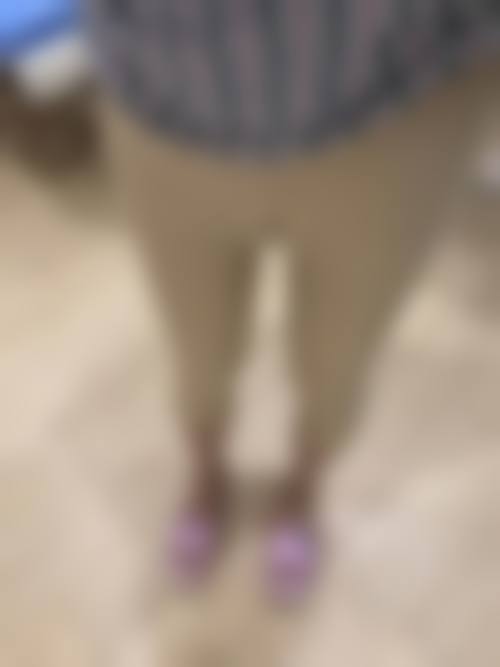 抽脂修复的避坑与实操建议