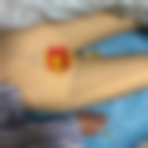 抽脂修复周期及影响因素有哪些