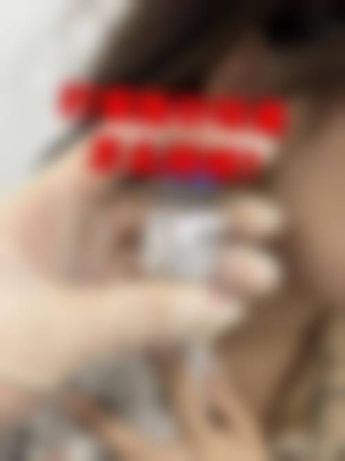 瘦脸针是什么?在什么情况下会被选择?