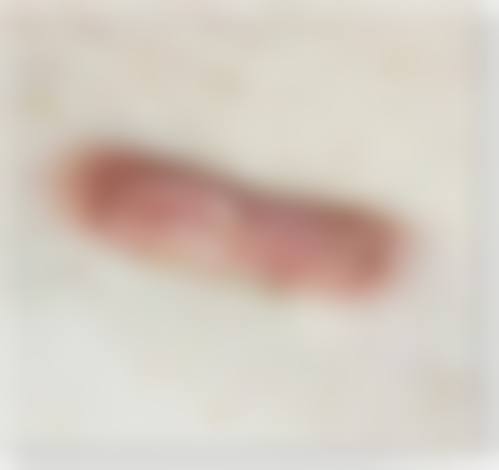 疤痕增生疙瘩咋去？药物800-3000元/激光2000-10000元/手术5000起有招