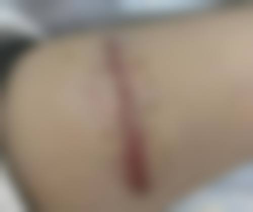 杭州鑫昕薇医疗美容门诊部正规资质及靠谱实力