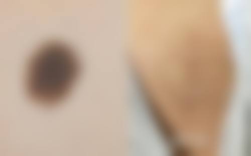 泰安美吉拉医疗美容诊所重点开展项目