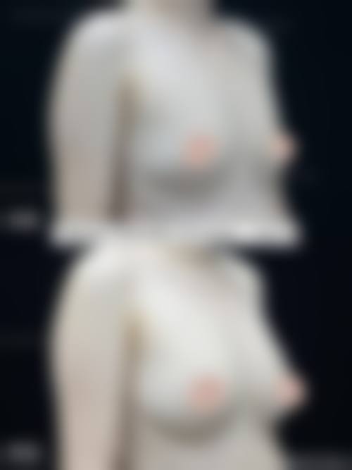 徐恩成医生擅长项目