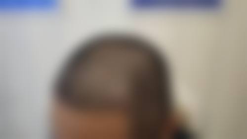 重庆五洲女子激光微整形医院预约挂号