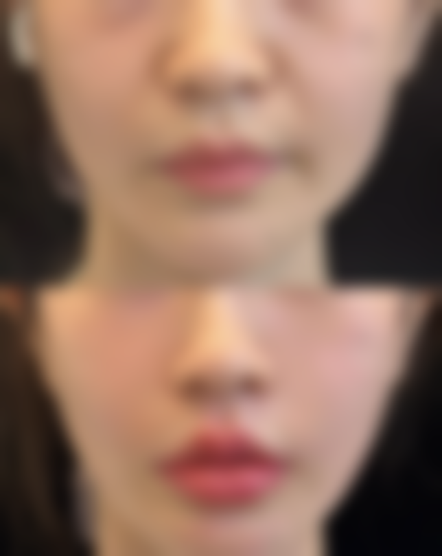 精选优质医院与医生——手术成功的基石