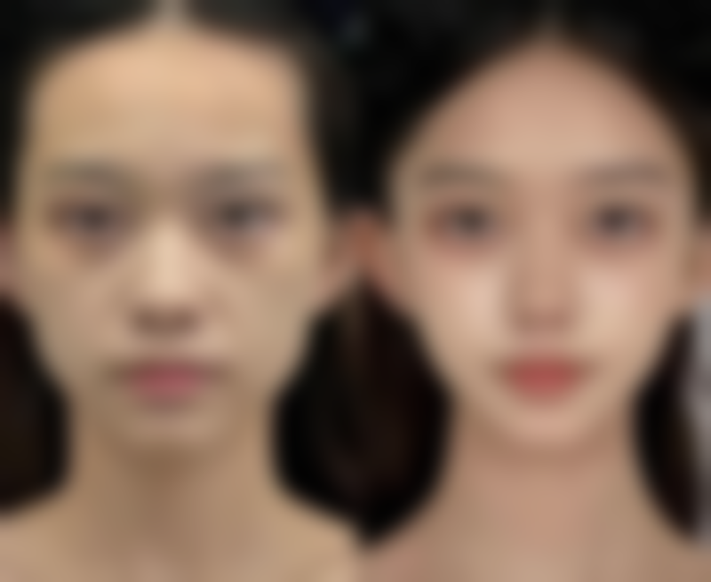 不同手术方式的适合人群及特点