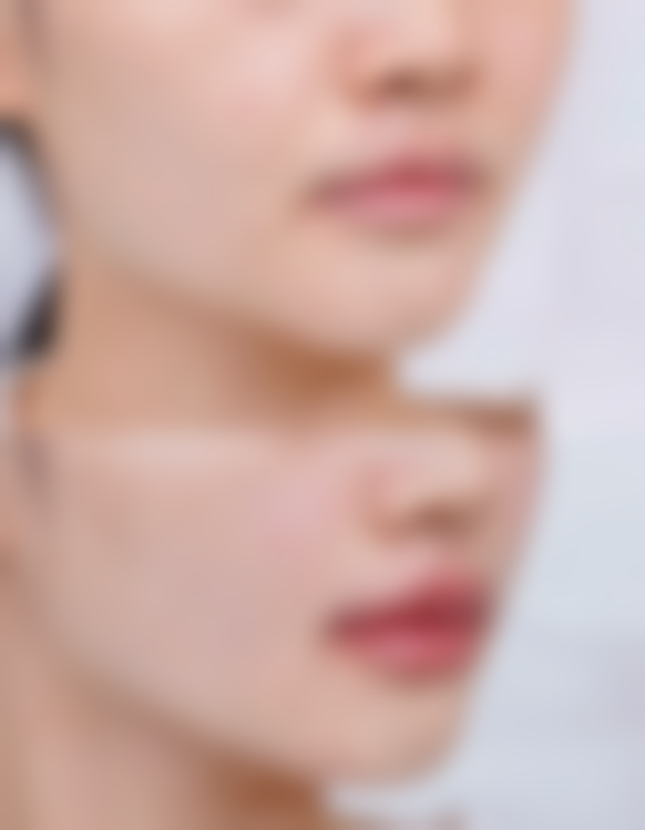 八、肋骨隆鼻的成效稳定性取决于哪些因素？