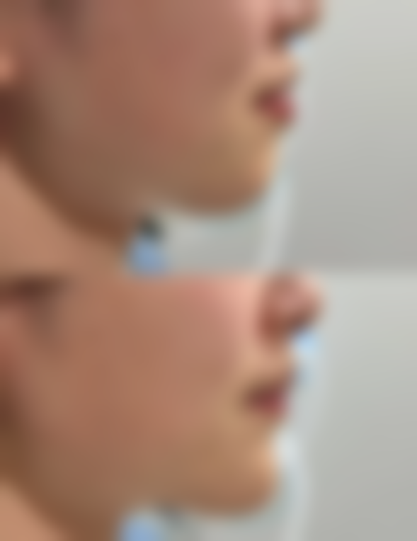 十、选择肋骨隆鼻相关医院与医生时，应重点看哪些维度？