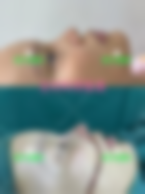 朱红伟医生擅长项目: