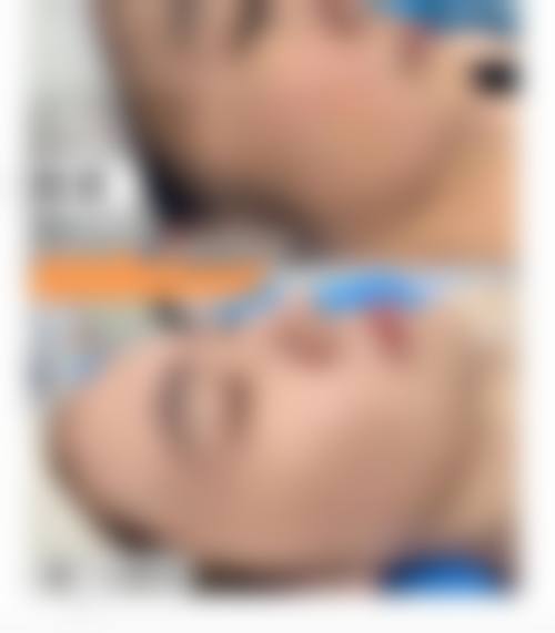 延安大学咸阳医院医疗美容科收费价格表/收费标准