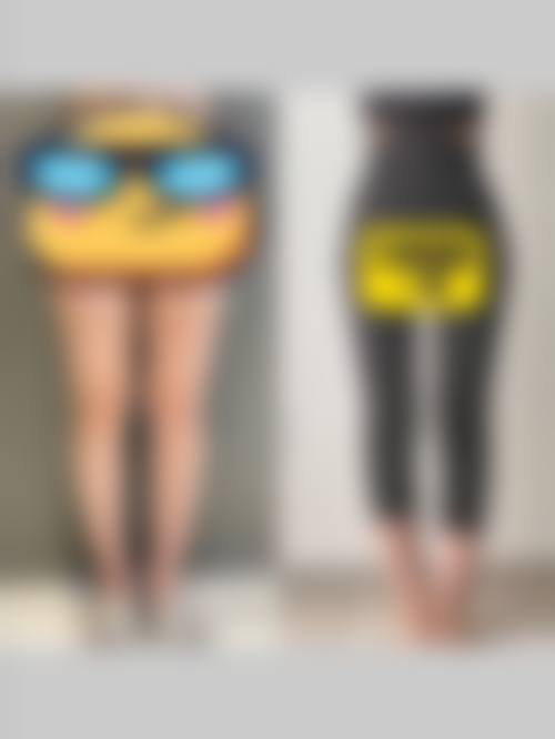 有哪些精良的抽脂技术，能帮助防止反弹呢？