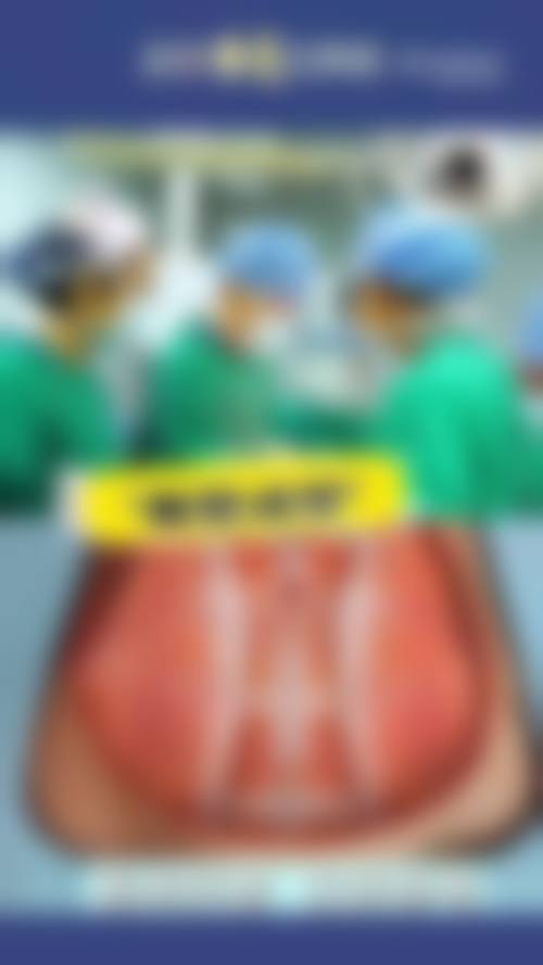 实际实例中，抽脂后真的不容易反弹吗？