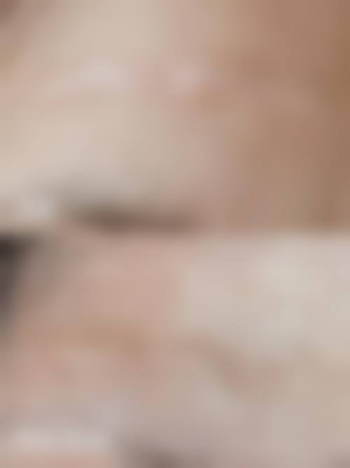 十、选择去除烫伤疤痕相关医院与医生时，应重点看哪些维度？