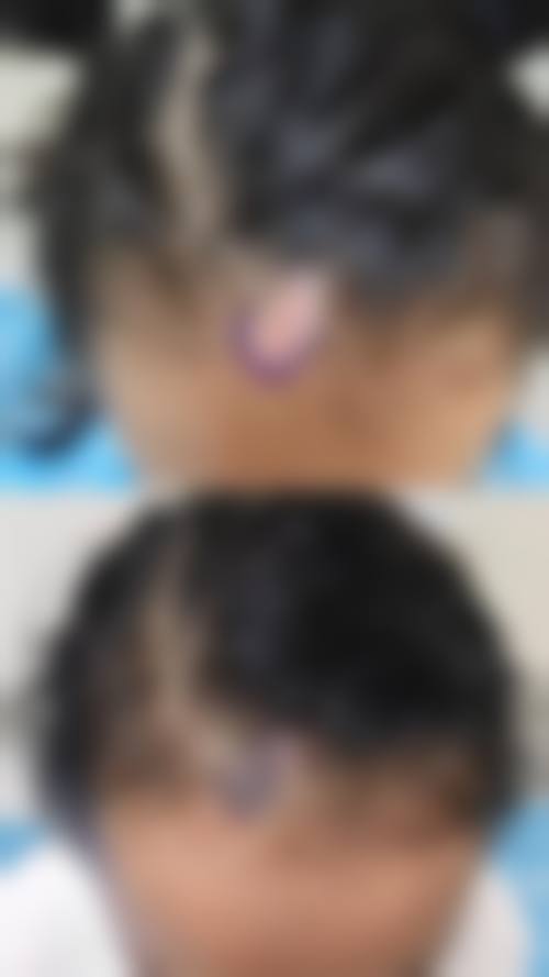 韩国Misoline整形医院预约挂号