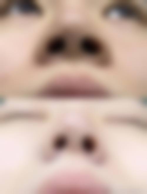 🌐深圳美瑞兒醫療美容院怎麼樣?