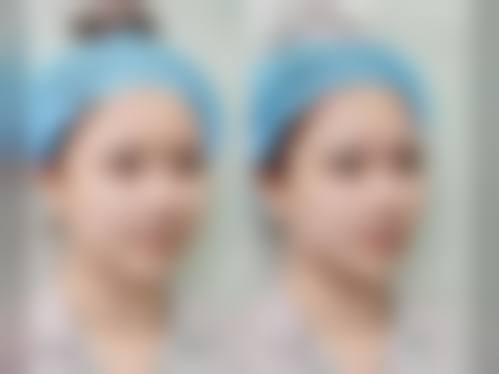 四、天津伊颜美医疗美容门诊常规及重点诊疗项目