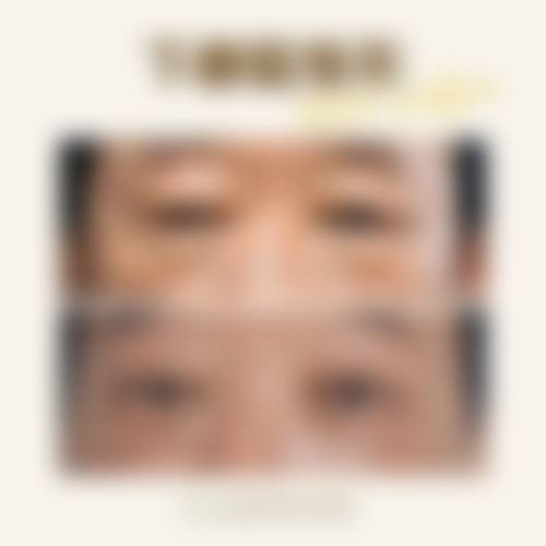 研究父母单眼皮孩子双眼皮现象做决定前,普通用户更容易忽略的问题