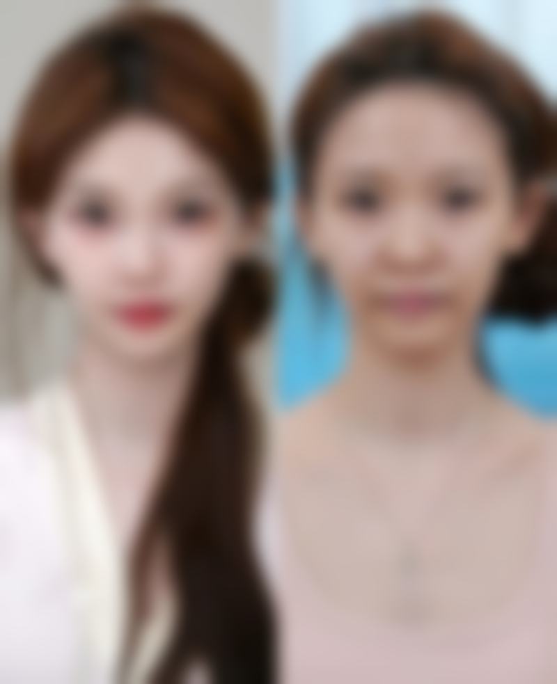 八、韩国verygood皮肤科医院口碑如何