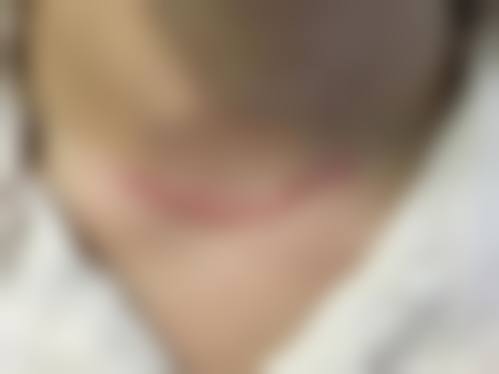 梅州曙光整形医疗美容医院口碑如何